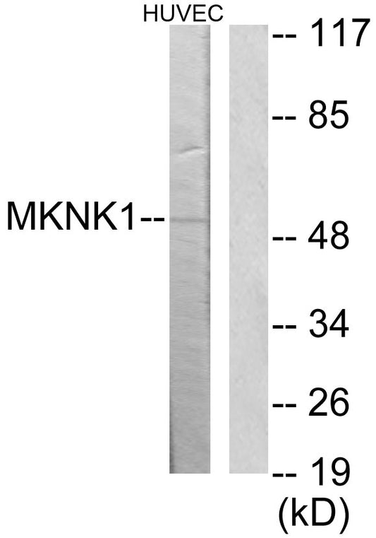 Mnk1 Rabbit Polyclonal Antibody