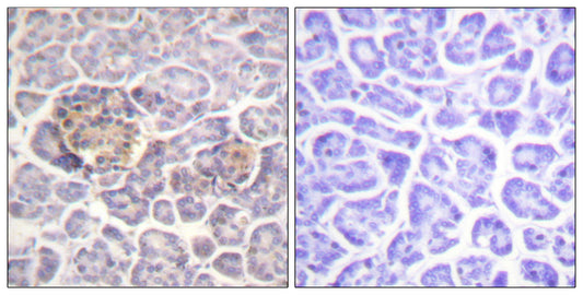 Moesin/Ezrin/Radixin Rabbit Polyclonal Antibody