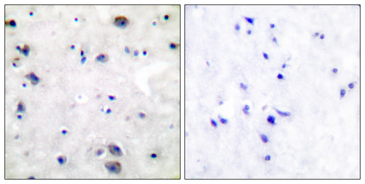MOR-1 Rabbit Polyclonal Antibody