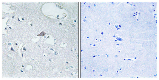 MOR-1 Rabbit Polyclonal Antibody