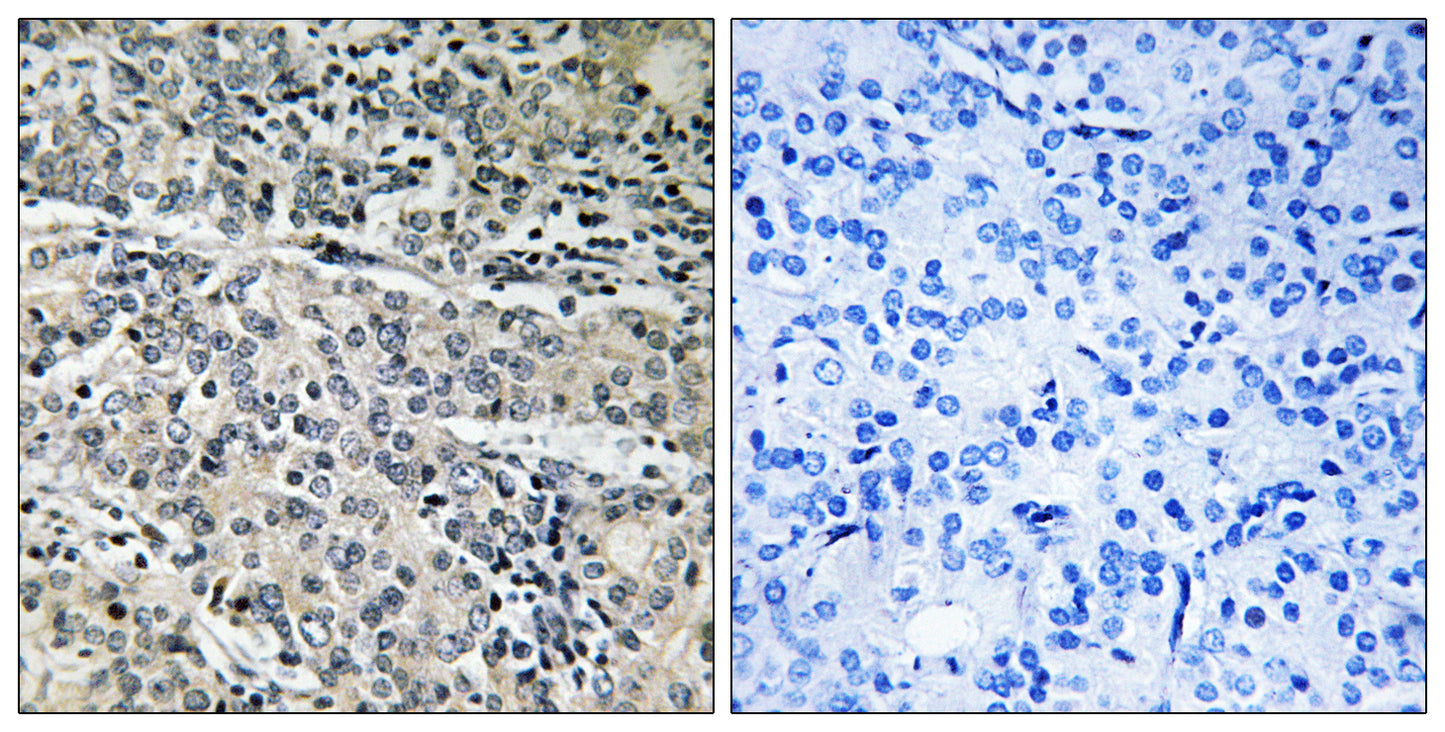 MP68 Rabbit Polyclonal Antibody