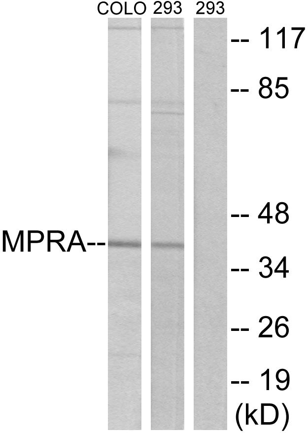 mPRα Rabbit Polyclonal Antibody