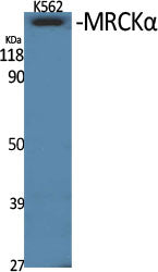 MRCKα Rabbit Polyclonal Antibody