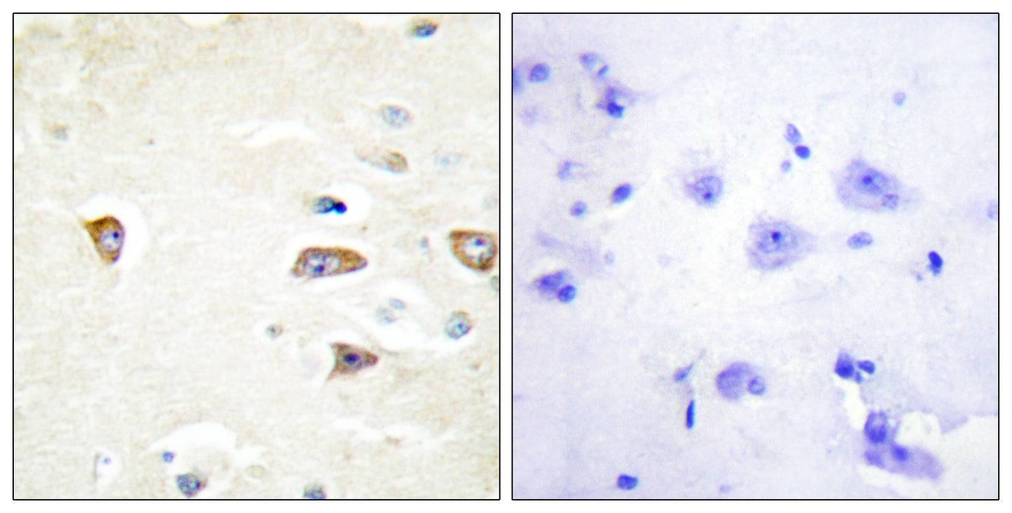 MRCKβ Rabbit Polyclonal Antibody