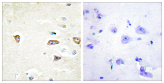 MRCKβ Rabbit Polyclonal Antibody