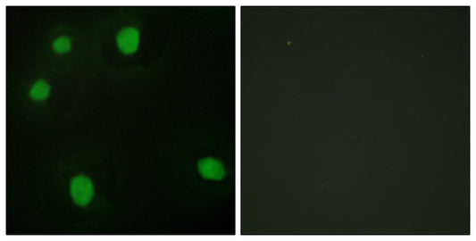 MRG15 Rabbit Polyclonal Antibody