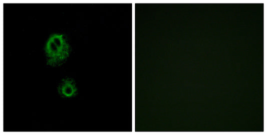MRGG Rabbit Polyclonal Antibody