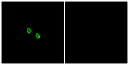 MRGX1 Rabbit Polyclonal Antibody