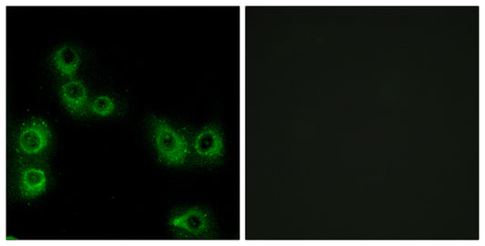 MRGX3 Rabbit Polyclonal Antibody