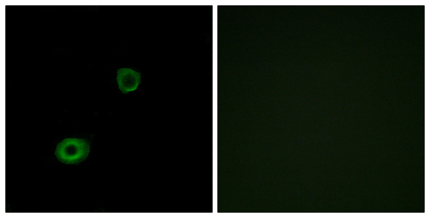 MRGX4 Rabbit Polyclonal Antibody