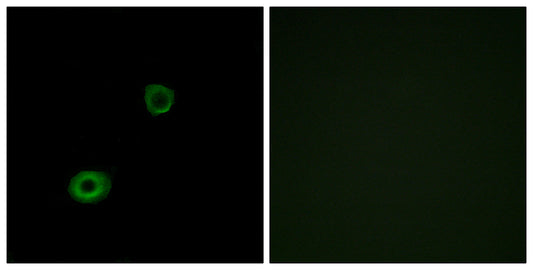 MRGX4 Rabbit Polyclonal Antibody