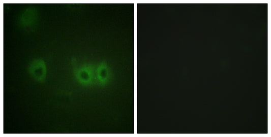 MRLC2 Rabbit Polyclonal Antibody