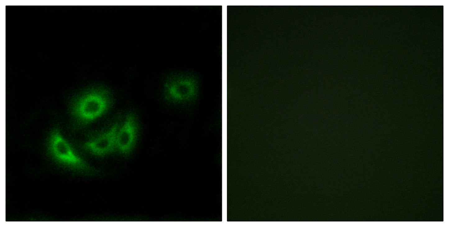 MRP-L11 Rabbit Polyclonal Antibody
