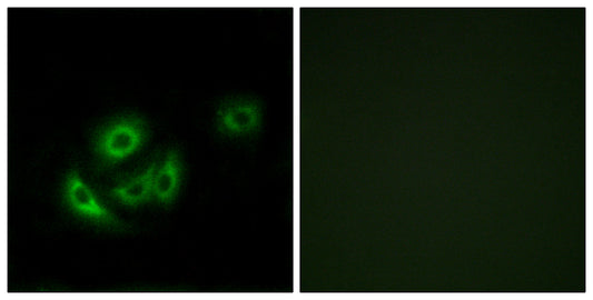 MRP-L11 Rabbit Polyclonal Antibody