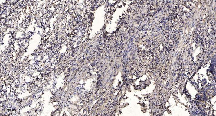 MRP-L17 Rabbit Polyclonal Antibody