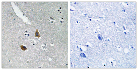 MRP-L21 Rabbit Polyclonal Antibody