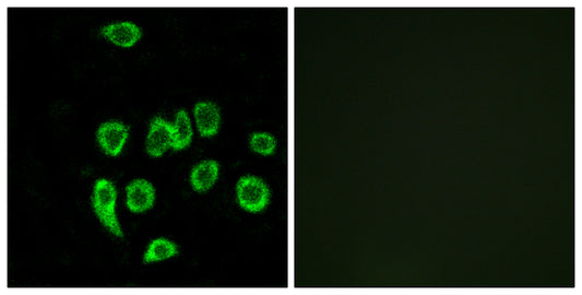 MRP-L32 Rabbit Polyclonal Antibody