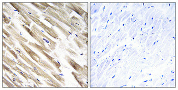 MRP-L33 Rabbit Polyclonal Antibody
