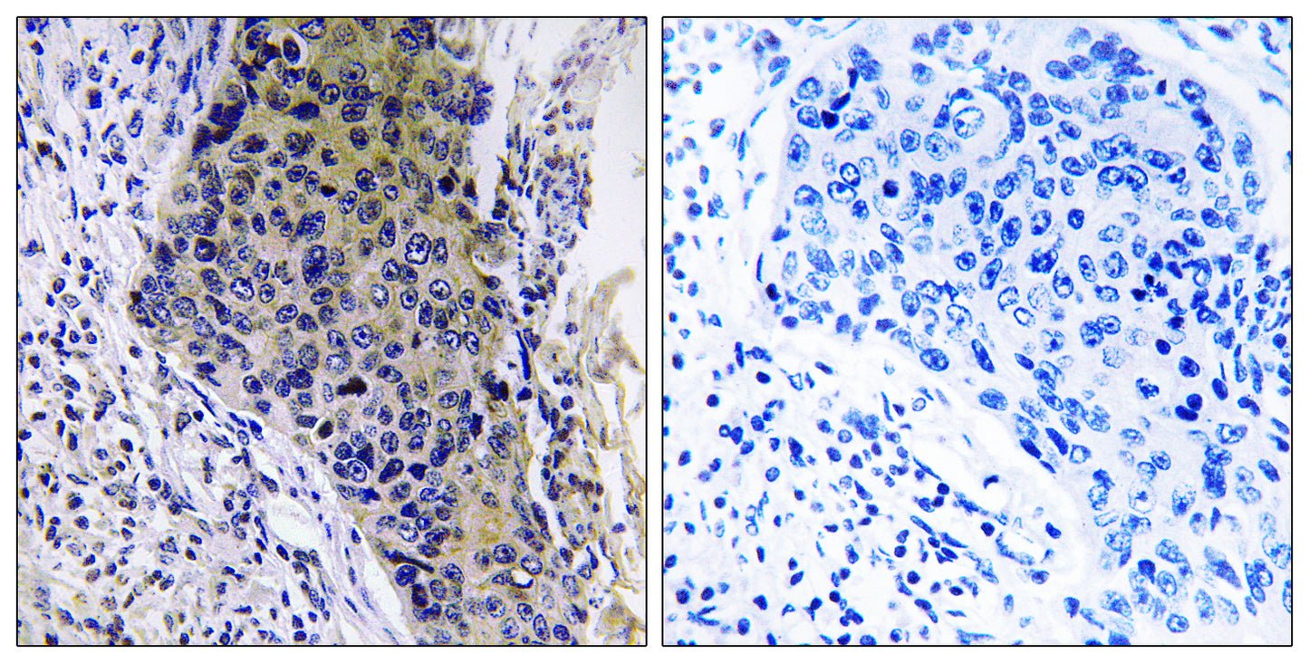 MRP-L34 Rabbit Polyclonal Antibody