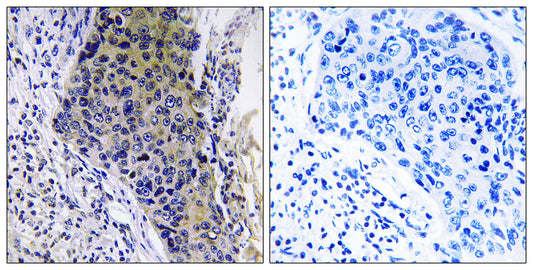 MRP-L34 Rabbit Polyclonal Antibody
