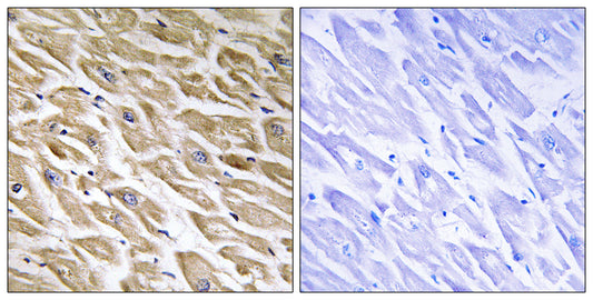 MRP-L39 Rabbit Polyclonal Antibody