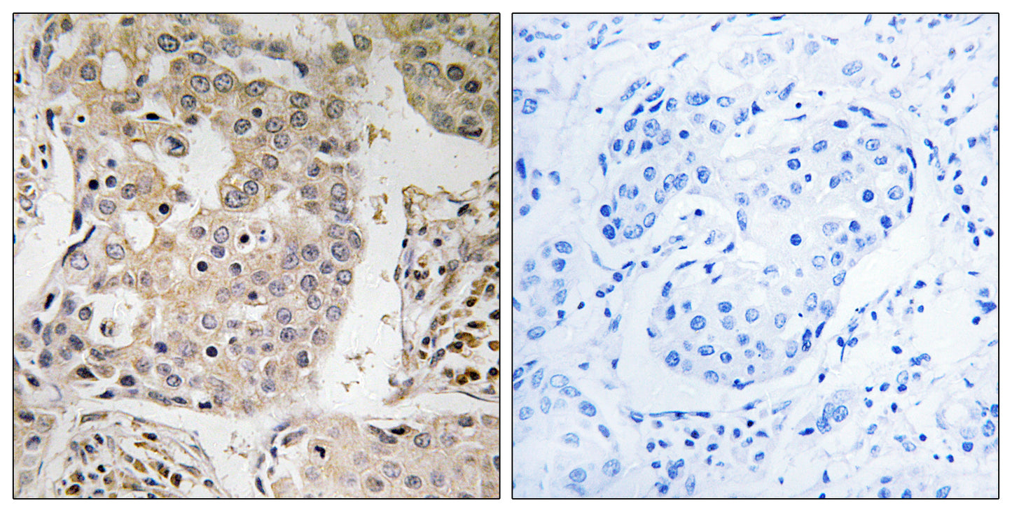 MRP-L41 Rabbit Polyclonal Antibody