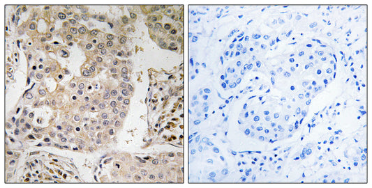 MRP-L41 Rabbit Polyclonal Antibody