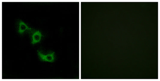 MRP-L44 Rabbit Polyclonal Antibody
