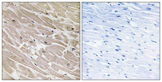 MRP-L46 Rabbit Polyclonal Antibody