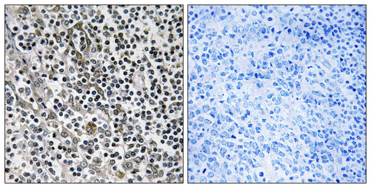 MRP-L51 Rabbit Polyclonal Antibody
