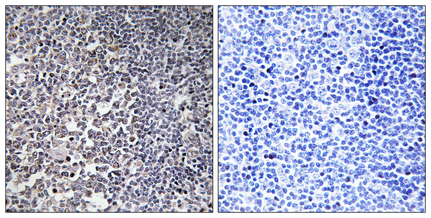 MRP-S16 Rabbit Polyclonal Antibody