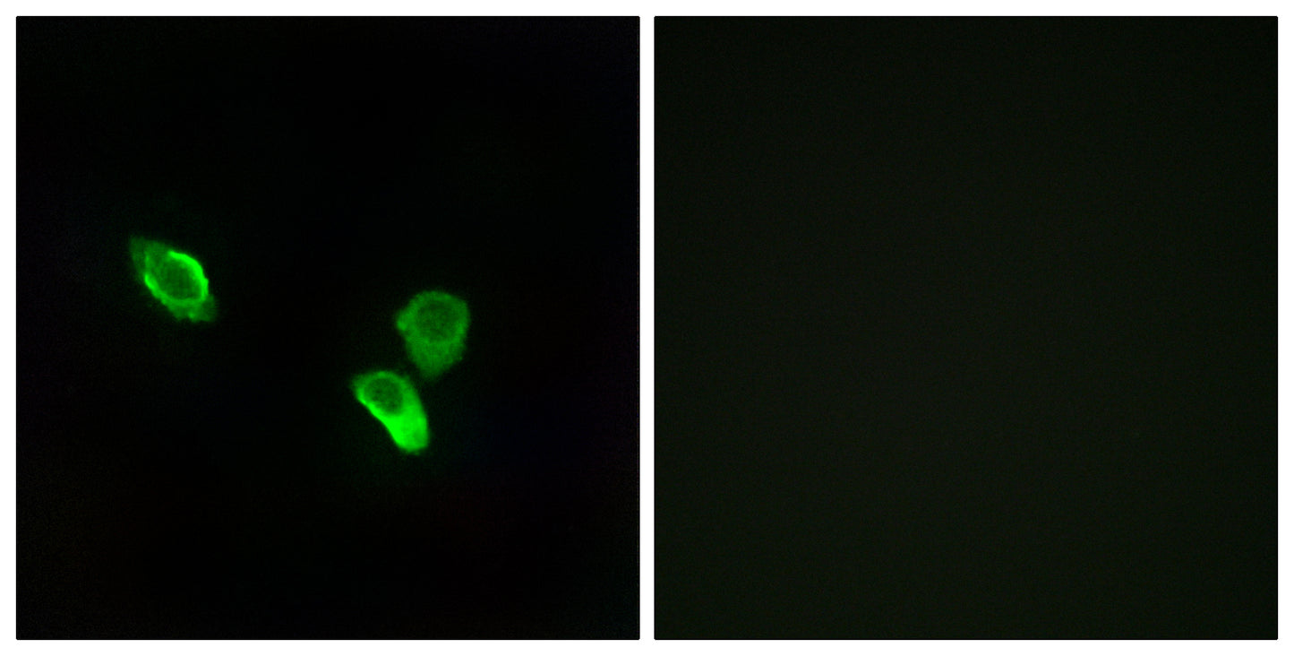 MRP-S18C Rabbit Polyclonal Antibody