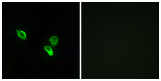 MRP-S18C Rabbit Polyclonal Antibody