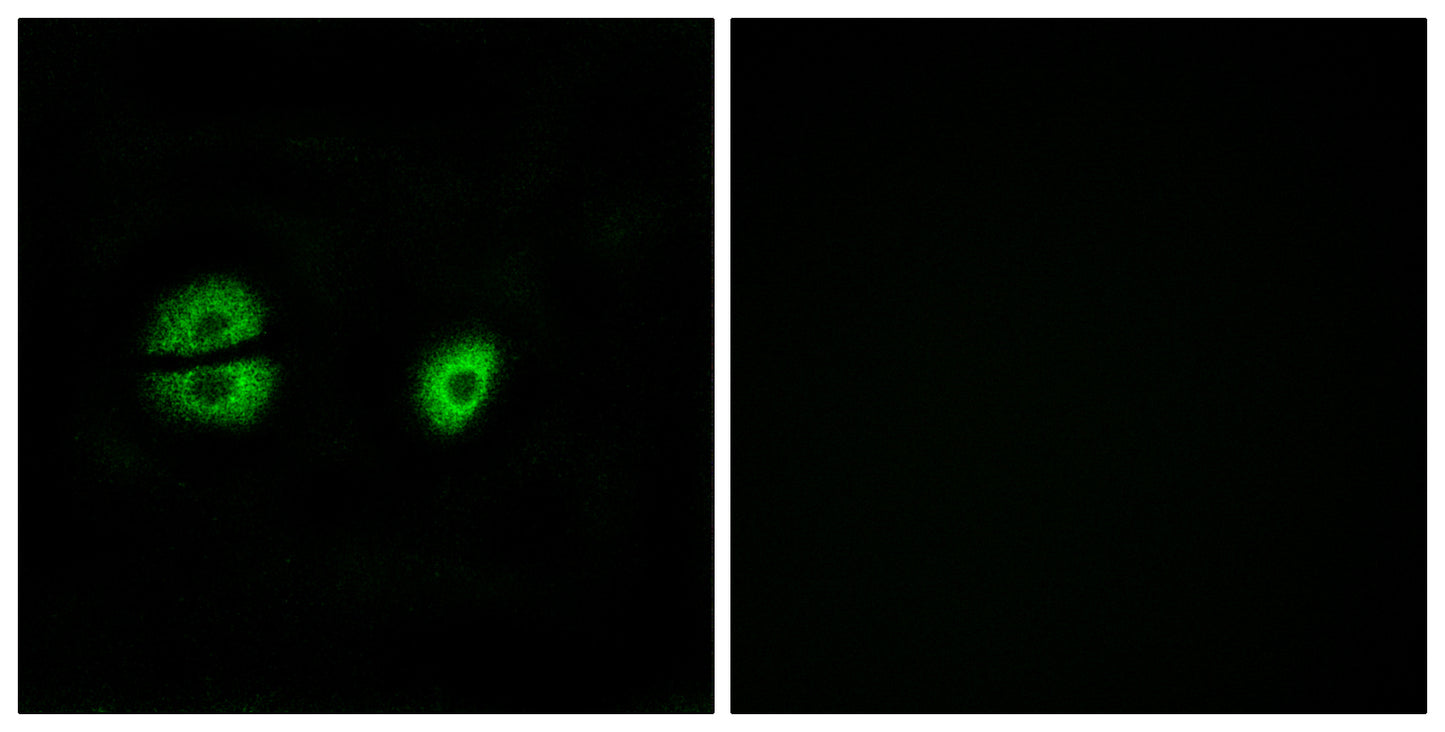 MRP-S22 Rabbit Polyclonal Antibody