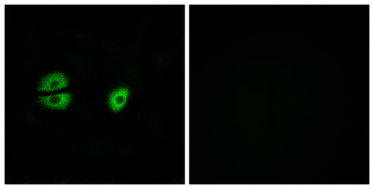 MRP-S22 Rabbit Polyclonal Antibody