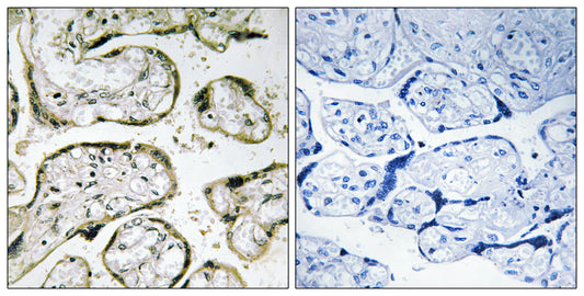 MRP-S32 Rabbit Polyclonal Antibody