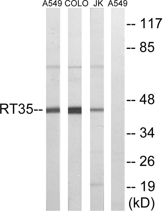 MRP-S35 Rabbit Polyclonal Antibody