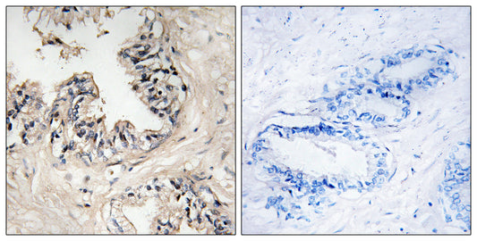 MRP-S36 Rabbit Polyclonal Antibody