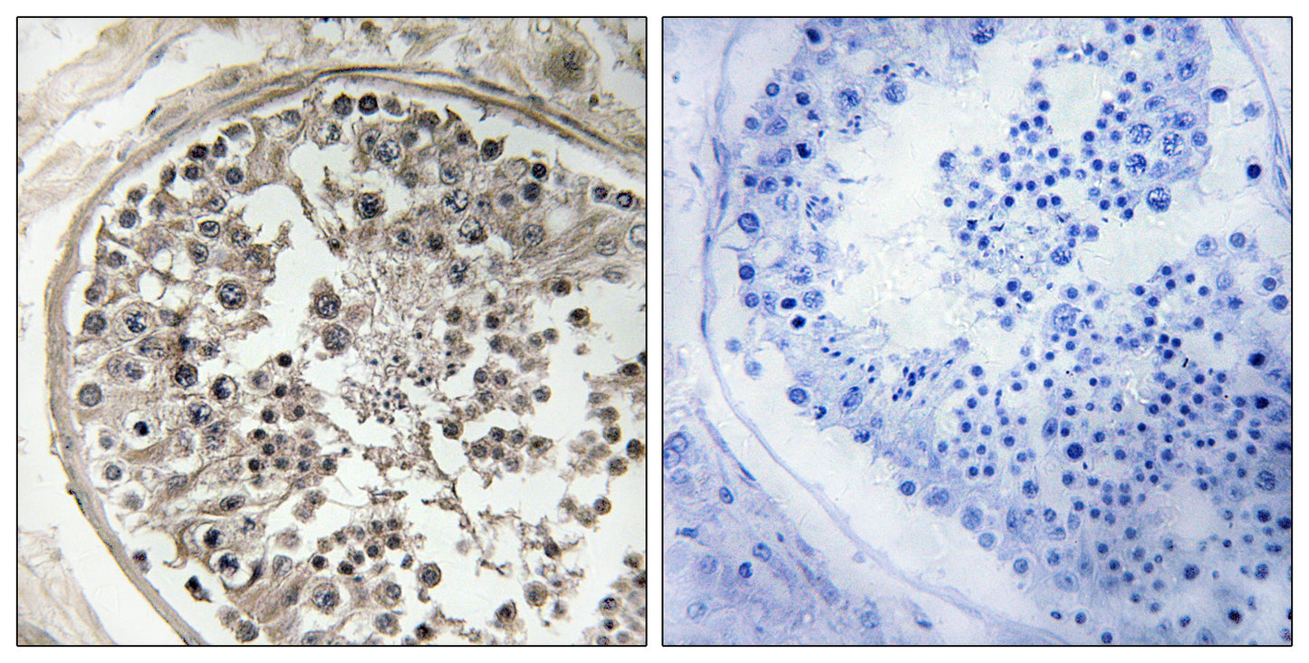 MRP-S5 Rabbit Polyclonal Antibody