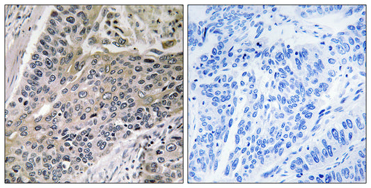 MRP-S7 Rabbit Polyclonal Antibody