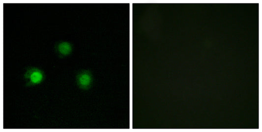 MSH2 Rabbit Polyclonal Antibody