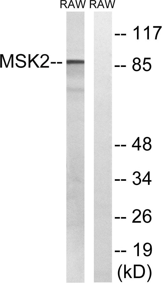 MSK2 Rabbit Polyclonal Antibody