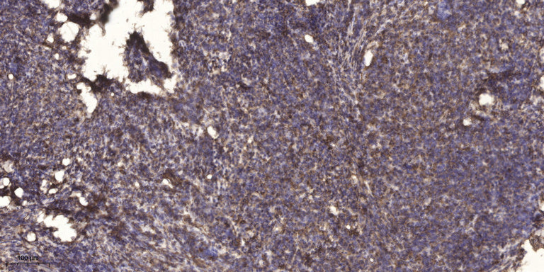 MT-ATP8 Rabbit Polyclonal Antibody
