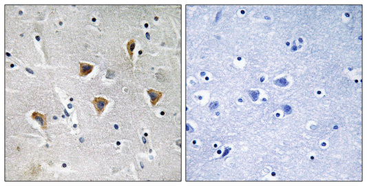 mTERF Rabbit Polyclonal Antibody