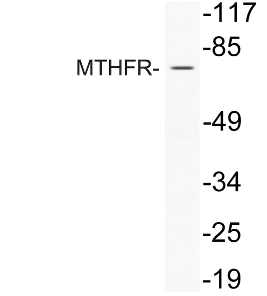 MTHFR Rabbit Polyclonal Antibody