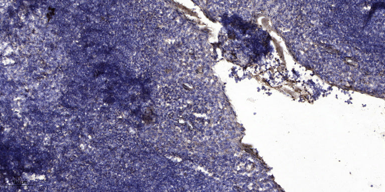 MUC5B Rabbit Polyclonal Antibody