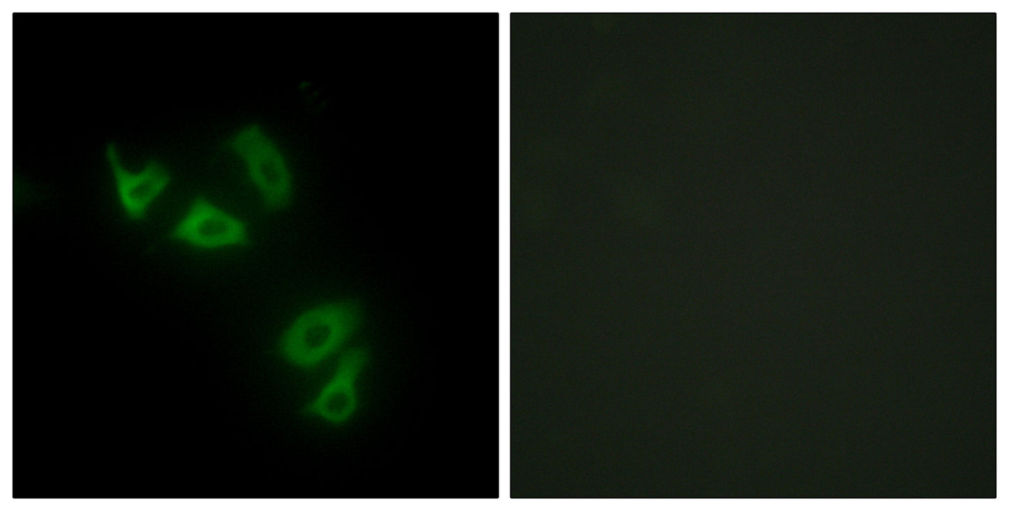 Mucin 13 Rabbit Polyclonal Antibody