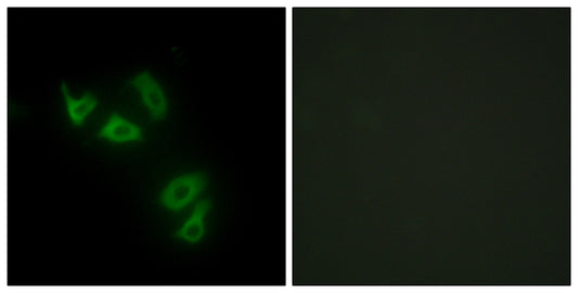 Mucin 13 Rabbit Polyclonal Antibody