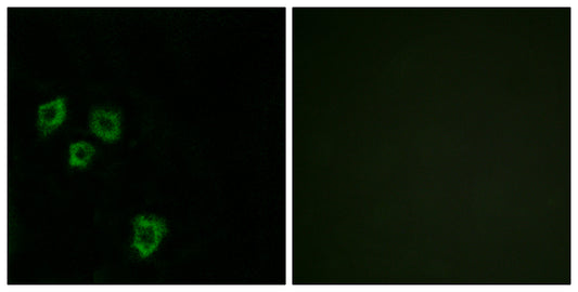 Mucin 16 Rabbit Polyclonal Antibody