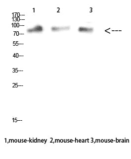 MUM1 Rabbit Polyclonal Antibody